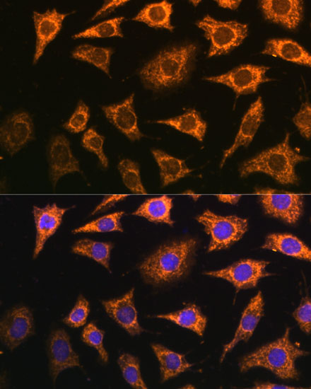 PDHA2 Polyclonal Antibody