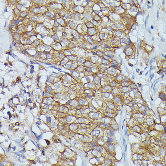 CTTN Polyclonal Antibody