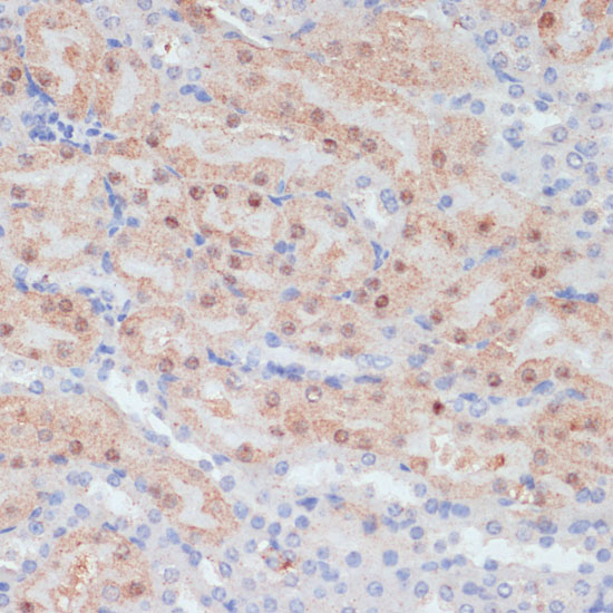 CLDN17 Polyclonal Antibody