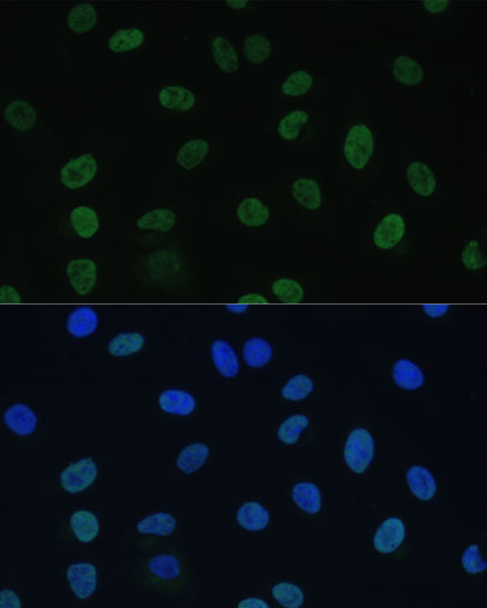 GTF2E1 Polyclonal Antibody