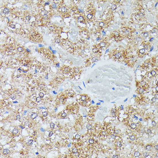 IVD Polyclonal Antibody