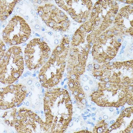 PLS1 Polyclonal Antibody