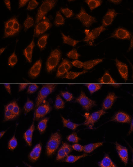 GFPT2 Polyclonal Antibody
