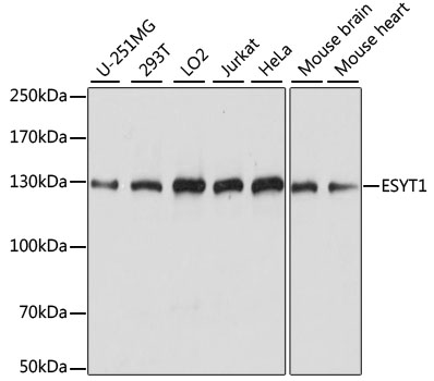 ESYT1 Polyclonal Antibody