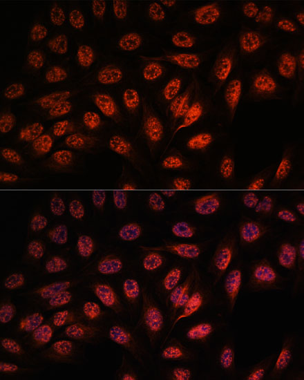 RBM25 Polyclonal Antibody