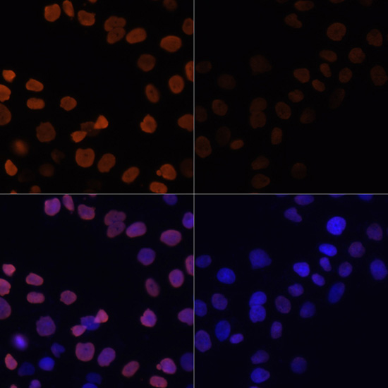 Acetyl-Histone H2B-K12 pAb