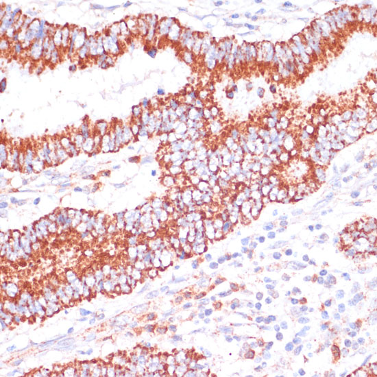 ENTPD6 Polyclonal Antibody