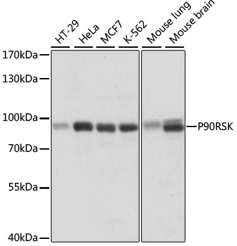 P90RSK Polyclonal Antibody