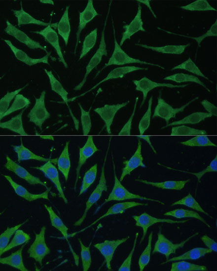 TIMM8B Polyclonal Antibody