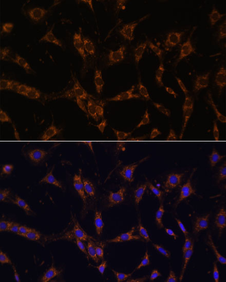 UBE2J1 Polyclonal Antibody