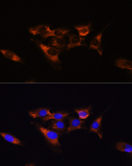 ADORA2A antibody