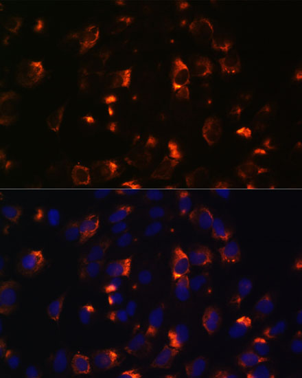 CCDC47 Polyclonal Antibody