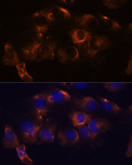 ATL2 Polyclonal Antibody