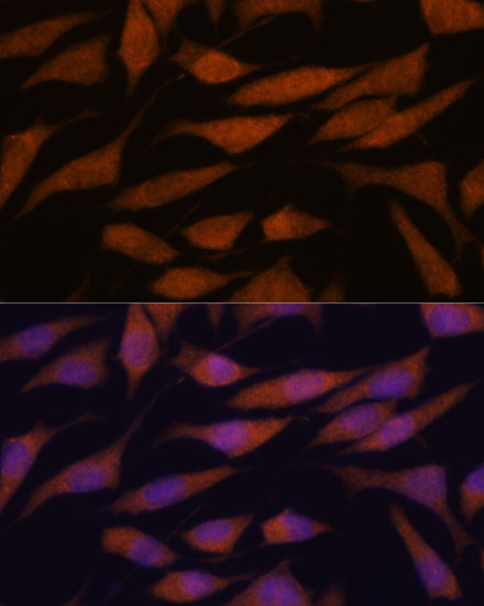DDX31 Polyclonal Antibody