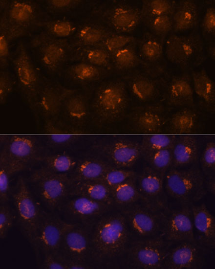 B3GNT4 Polyclonal Antibody