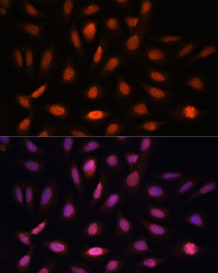 PPIL4 Polyclonal Antibody