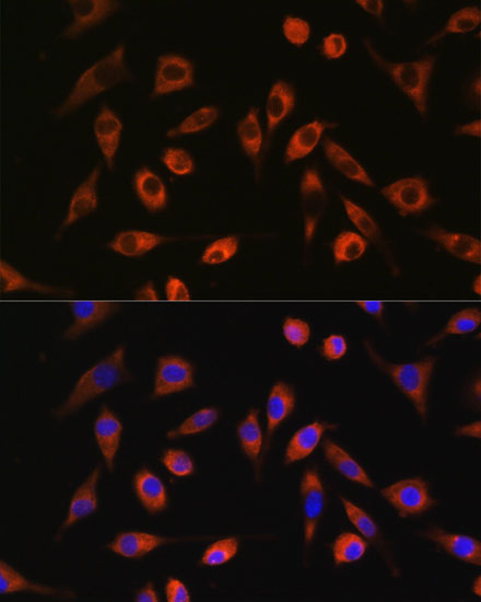TP53I13 Polyclonal Antibody