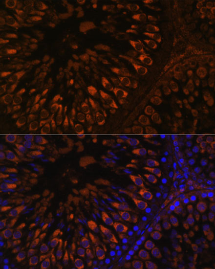 FER1L5 Polyclonal Antibody