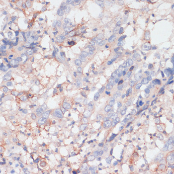 ZNRF3 Polyclonal Antibody