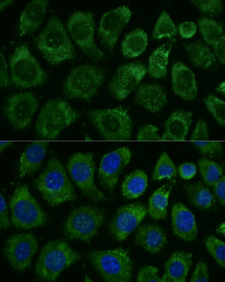 MAP3K1 Polyclonal Antibody