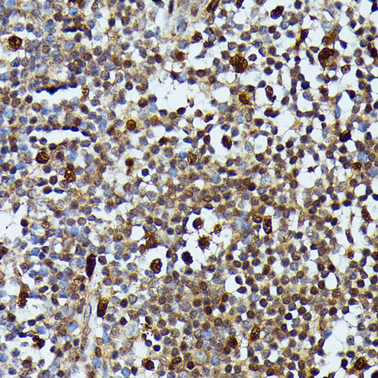 MAP3K3 Polyclonal Antibody