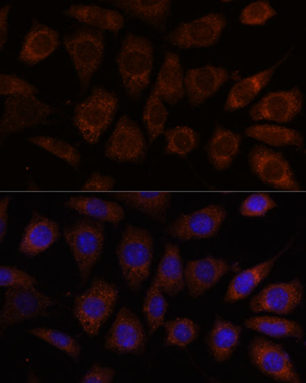 SEC24D Polyclonal Antibody