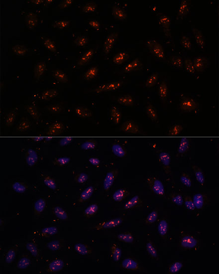 DNTTIP2 Polyclonal Antibody