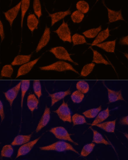 TRAPPC6A Polyclonal Antibody