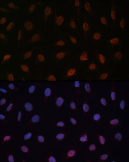 MED25 Polyclonal Antibody