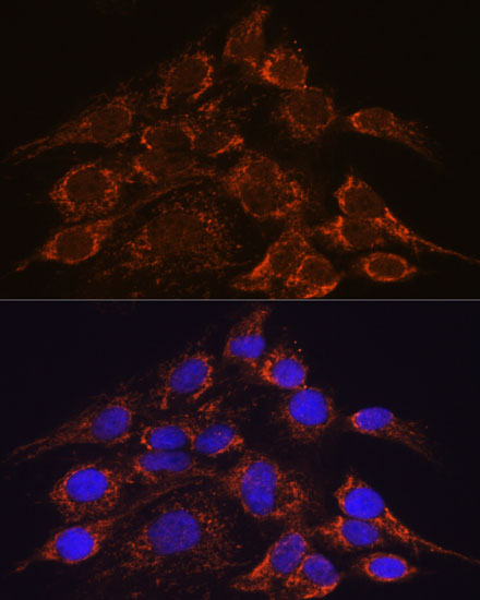 HPS4 Polyclonal Antibody