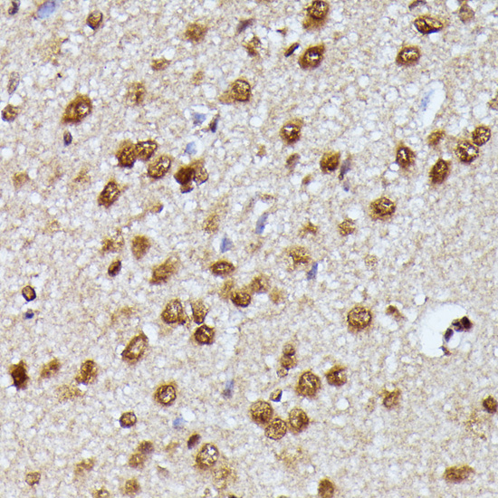 KIAA1429 Polyclonal Antibody