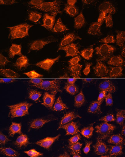 PTCD1 Polyclonal Antibody