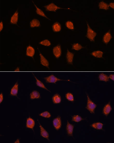 KCNAB2 Polyclonal Antibody