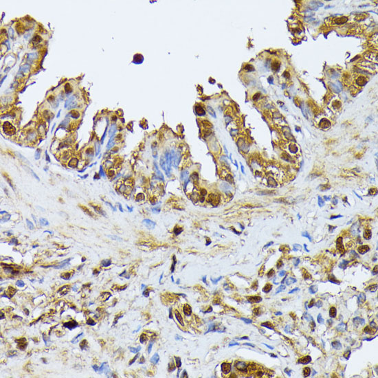 SMN2 Polyclonal Antibody