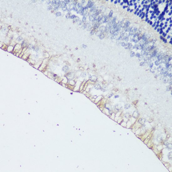 OPN4 Polyclonal Antibody