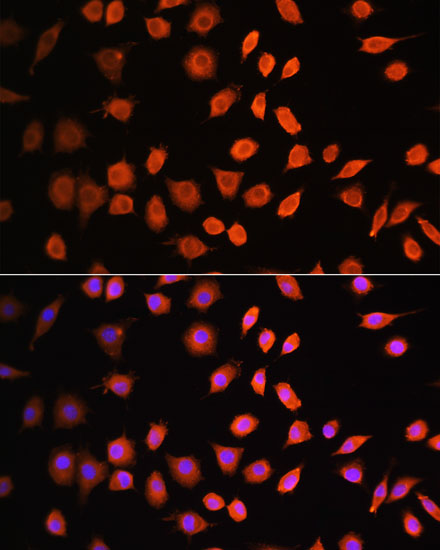 CDK6 antibody