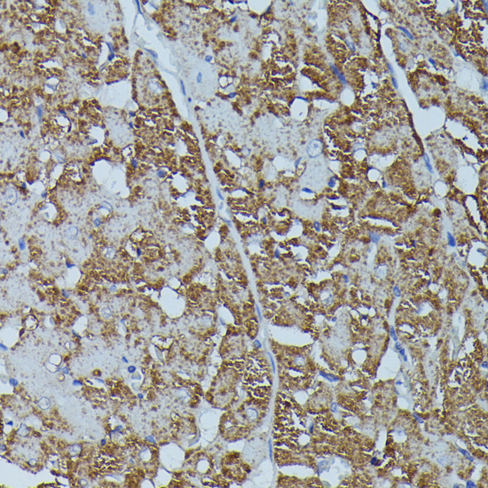 FKBP1B Polyclonal Antibody