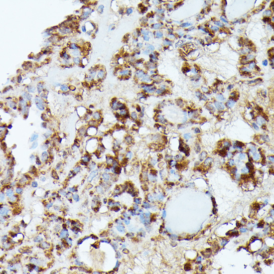 NUBP1 Polyclonal Antibody