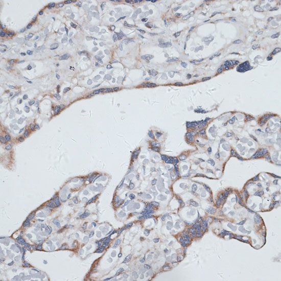 PLAA Polyclonal Antibody