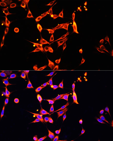 Heparanase 1 Polyclonal Antibody