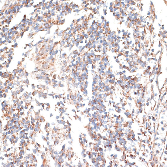 KATNA1 Polyclonal Antibody