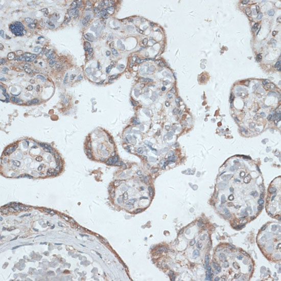 PMEPA1 Polyclonal Antibody