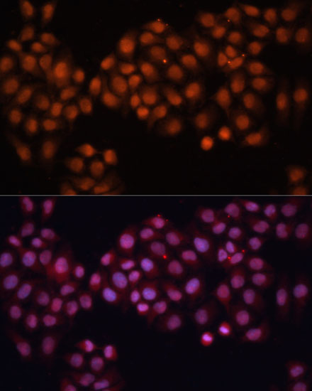 CDC25A Antibody