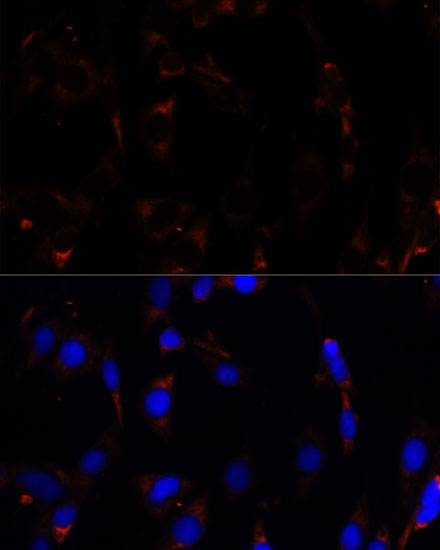 RPL26 Polyclonal Antibody