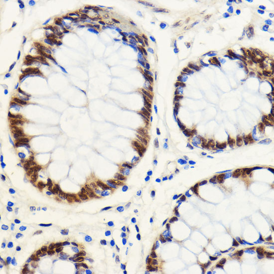 SNIP1 Polyclonal Antibody