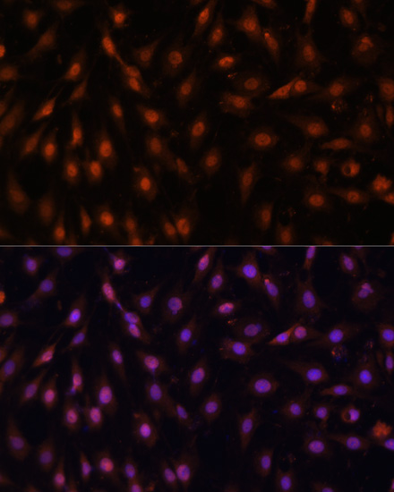 P70 S6K Polyclonal Antibody