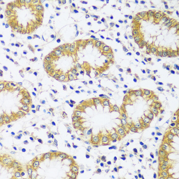 CADPS Polyclonal Antibody