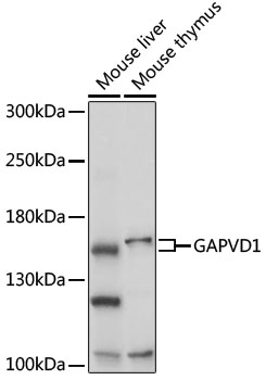 GAPVD1 Polyclonal Antibody