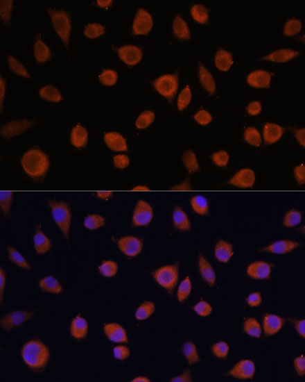ZCCHC3 Polyclonal Antibody