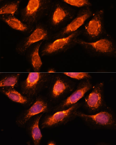RAB1A Polyclonal Antibody